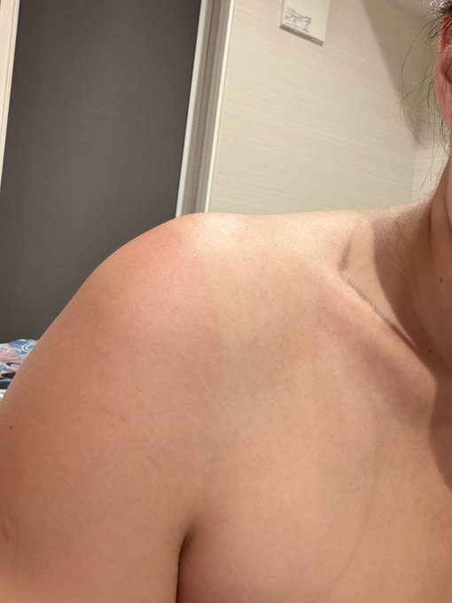 今日、日焼け止めをホテルに忘れてしまいました😭 屋上で二時間撮影したせいで、帰ってきてから露出した肌が少し日焼けしていることに気づきました。 明日は皆さん、ぜ… · Natsuko夏夏子💕C108(日)南 h-13b