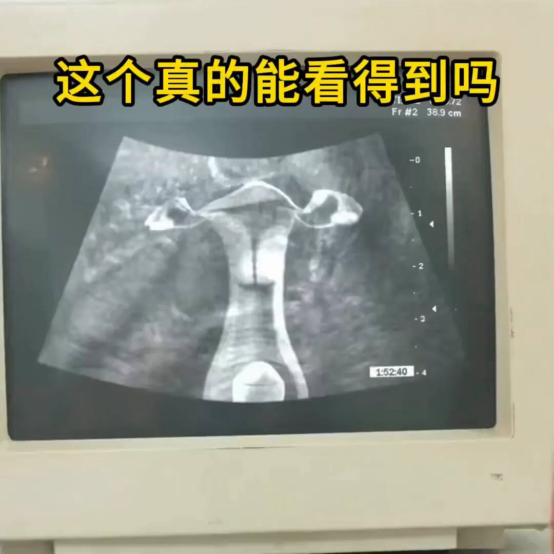 这是B超吗 真的能看到的肉棒吗 爸爸关注我！ · Movie studio